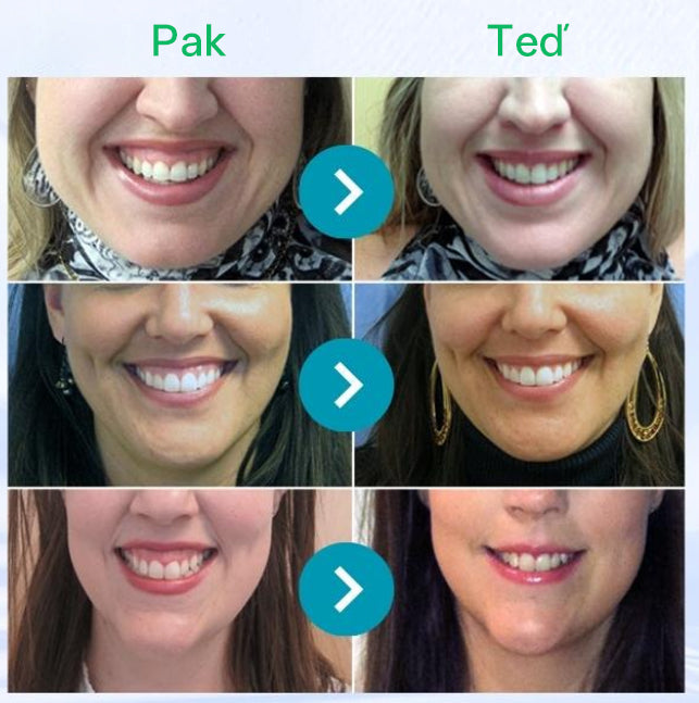 Furzero® Focusmile prášek s včelím jedem k perorálnímu užití 🦷