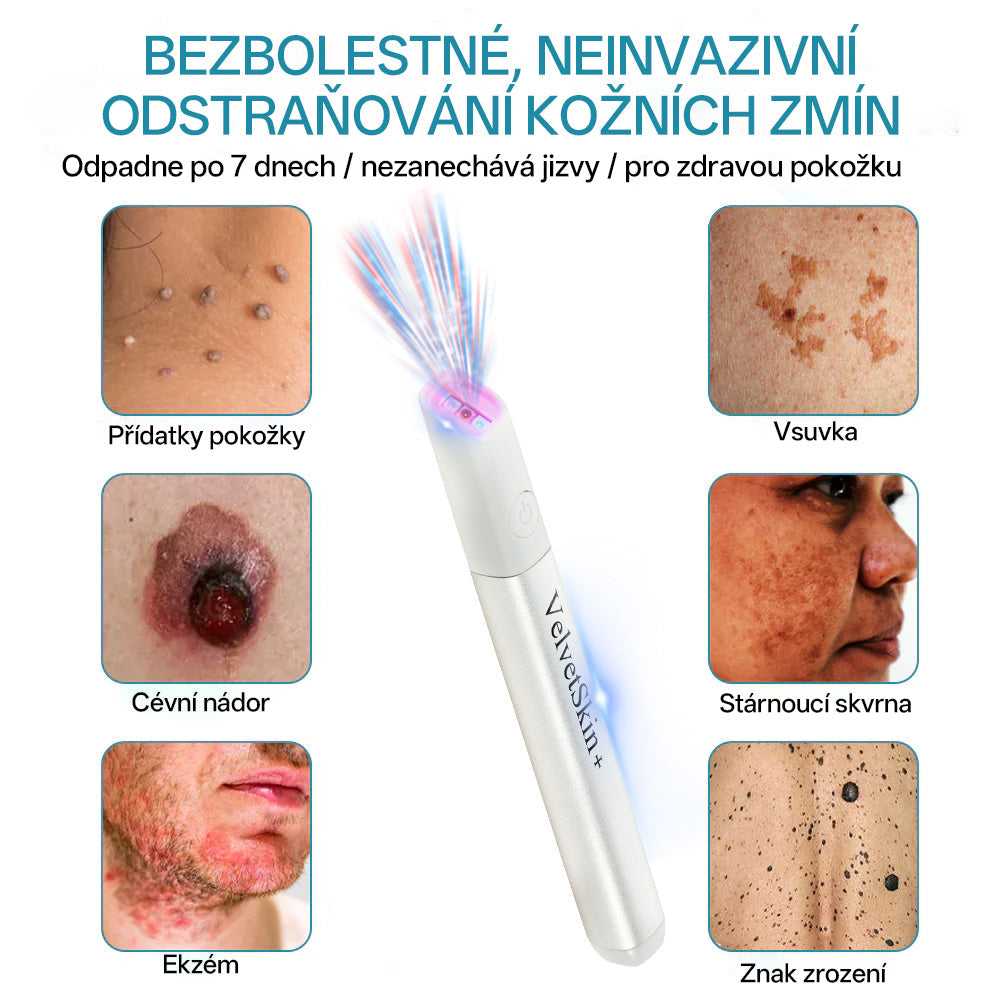 ✨ Bikenda® – CO₂ laserové pero na odstraňování 🟤 mateřských znamének, 🦠 bradavic, 🔘 skvrn a jiných nedokonalostí pleti💗