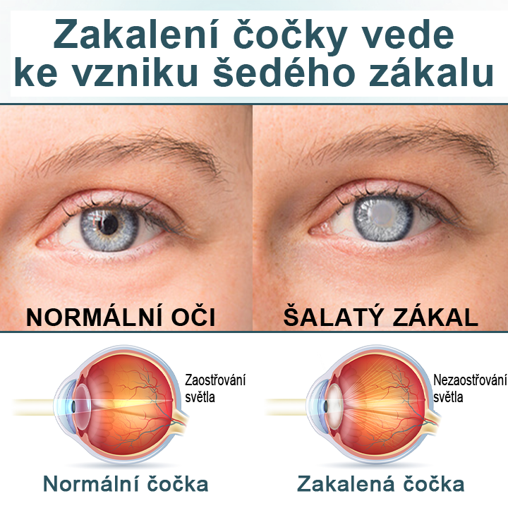 Oční kapky  optifusion nano sérum – nanotechnologie obnovuje jasný zrak, bez brýlí, bez chirurgického zákroku✨