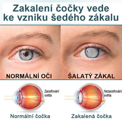 Oční kapky  optifusion nano sérum – nanotechnologie obnovuje jasný zrak, bez brýlí, bez chirurgického zákroku✨