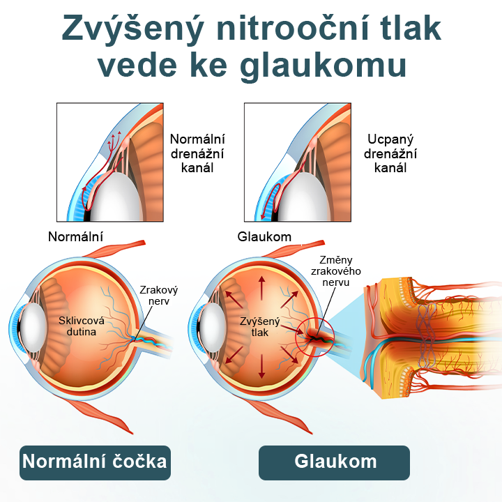 Oční kapky  optifusion nano sérum – nanotechnologie obnovuje jasný zrak, bez brýlí, bez chirurgického zákroku✨