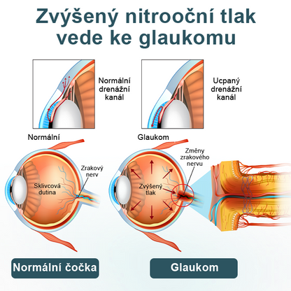 Oční kapky  optifusion nano sérum – nanotechnologie obnovuje jasný zrak, bez brýlí, bez chirurgického zákroku✨