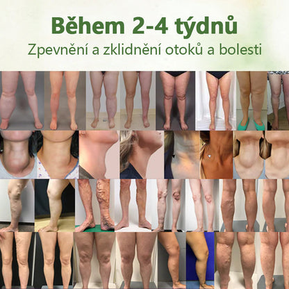 Bylinný lymfatický detoxikační krém Cvreoz®💫