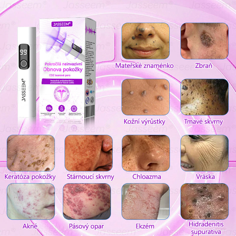 【Oficiální vlajkový obchod】𝐉𝐚𝐬𝐬𝐞𝐞𝐦® Pokročilé neinvazivní pero s CO₂ laserem na opravu pokožky 💕 (šetrně odstraňuje bradavice, mateřská znaménka, stařecké skvrny a kožní značky - bez bolesti a rozruchu!)💫