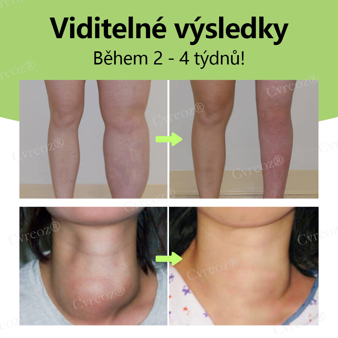 Bylinný lymfatický detoxikační krém Cvreoz®💫