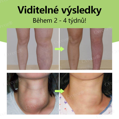 Bylinný lymfatický detoxikační krém Cvreoz®💫