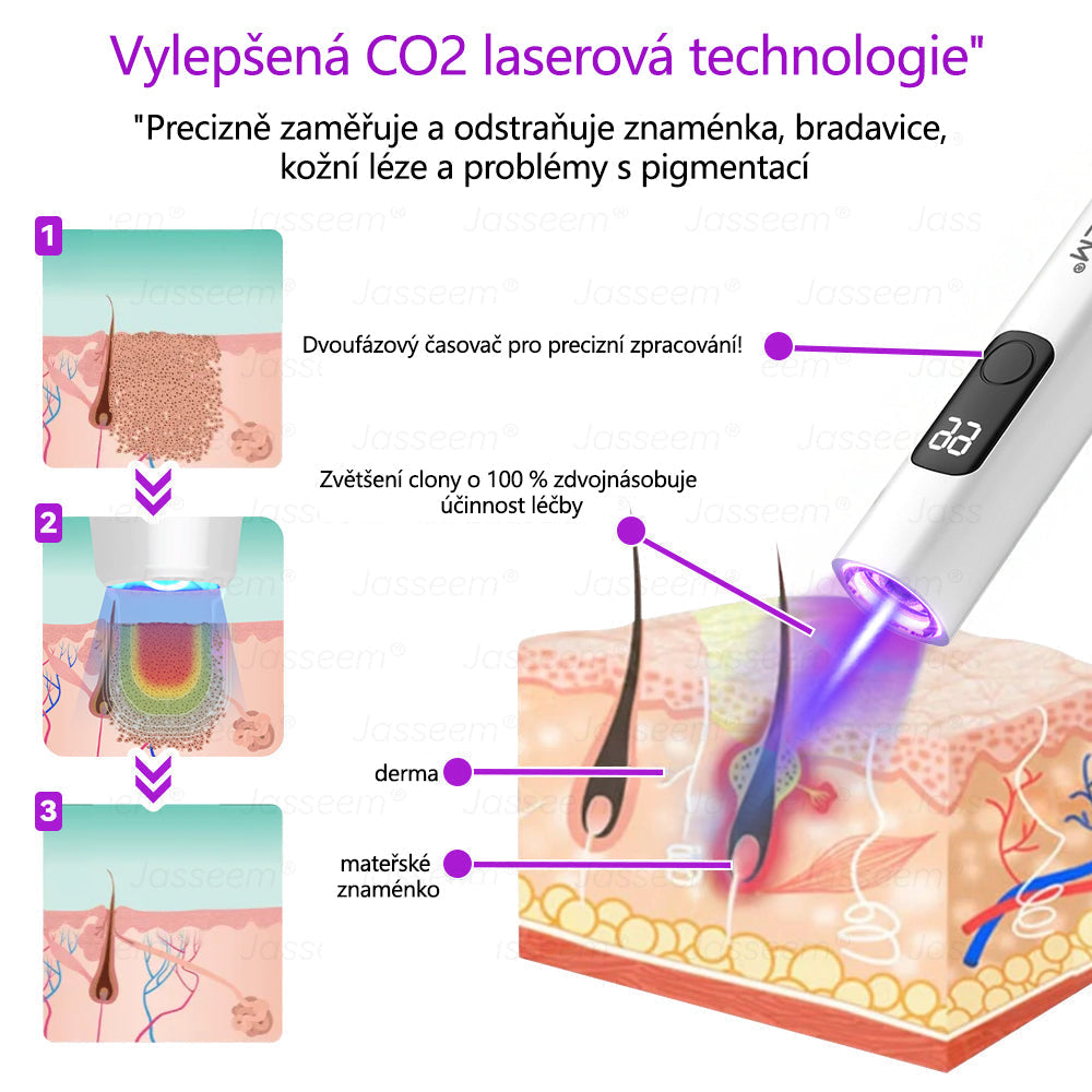 【Oficiální vlajkový obchod】𝐉𝐚𝐬𝐬𝐞𝐞𝐦® Pokročilé neinvazivní pero s CO₂ laserem na opravu pokožky 💕 (šetrně odstraňuje bradavice, mateřská znaménka, stařecké skvrny a kožní značky - bez bolesti a rozruchu!)💫