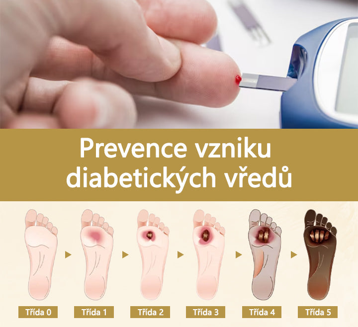 【Oficiální značkový obchod】Timilk® Sprej na hojení diabetické nohy - s obsahem včelího jedu❄️
