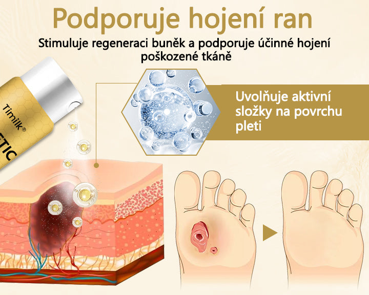 【Oficiální značkový obchod】Timilk® Sprej na hojení diabetické nohy - s obsahem včelího jedu❄️