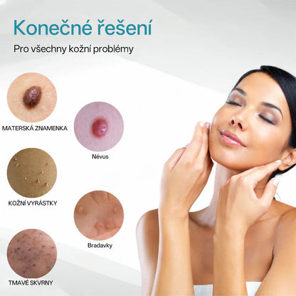 ✨ Bikenda® – CO₂ laserové pero na odstraňování 🟤 mateřských znamének, 🦠 bradavic, 🔘 skvrn a jiných nedokonalostí pleti💢