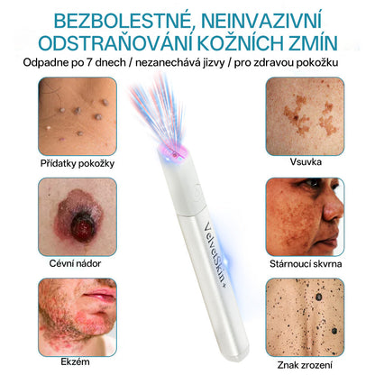 ✨ Bikenda® – CO₂ laserové pero na odstraňování 🟤 mateřských znamének, 🦠 bradavic, 🔘 skvrn a jiných nedokonalostí pleti💢