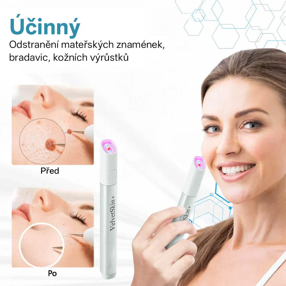 ✨ Bikenda® – CO₂ laserové pero na odstraňování 🟤 mateřských znamének, 🦠 bradavic, 🔘 skvrn a jiných nedokonalostí pleti💢
