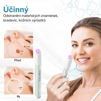 ✨ Bikenda® – CO₂ laserové pero na odstraňování 🟤 mateřských znamének, 🦠 bradavic, 🔘 skvrn a jiných nedokonalostí pleti💢